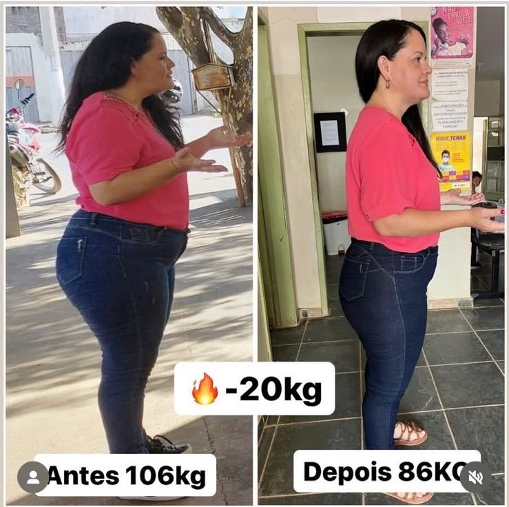 Comparativo de aluna antes e depois, com redução de 20 quilos